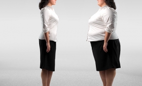 Diet tummy tuck without surgery after a natural birth